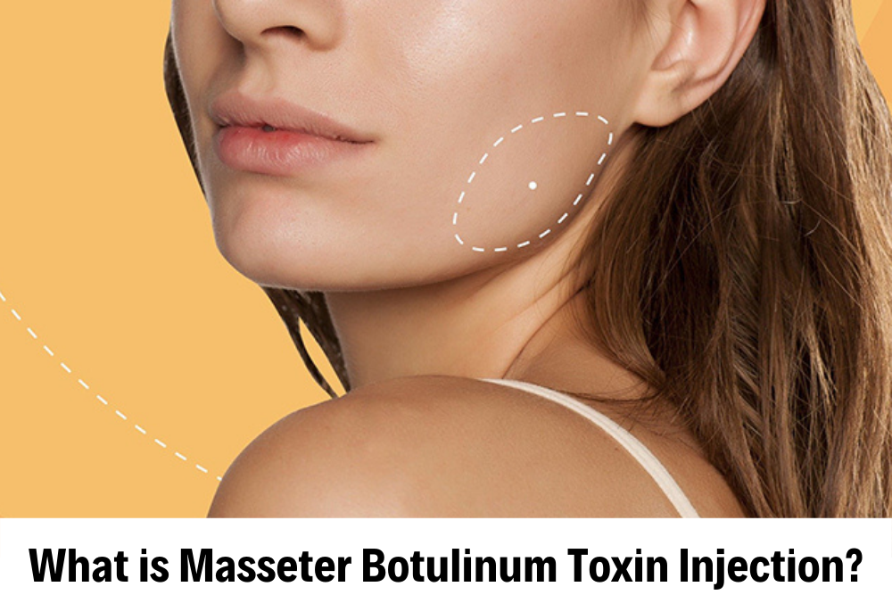 Masseter Treatment